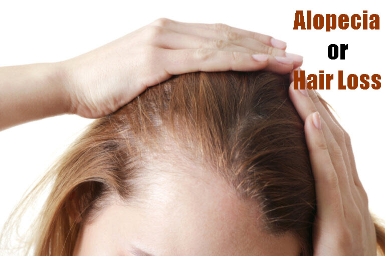 Alopecia or Hair Loss | Getcured Apothecary Pvt Ltd