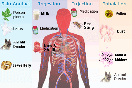 Causes and Types of Allergies