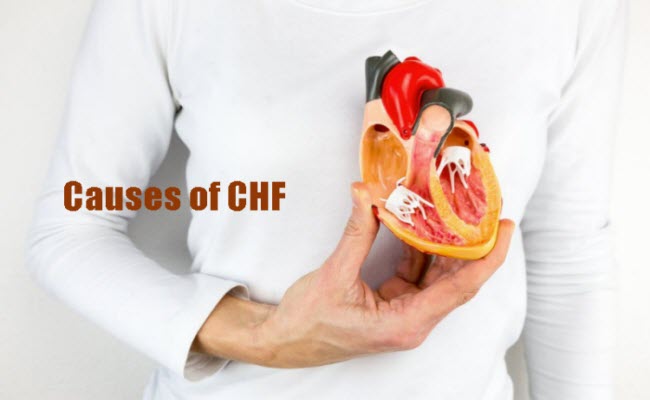 Causes of Congestive Heart Failure or CHF