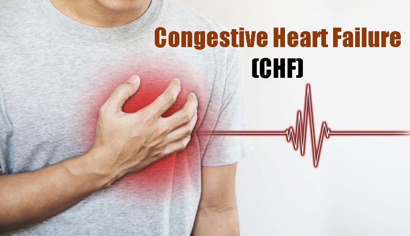 Congestive Heart Failure or CHF