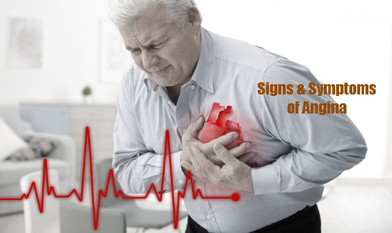 Signs and Symptoms of Angina Pectoris