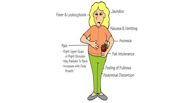 Signs and Symptoms of Cholecystitis