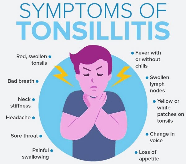 Signs and Symptoms of Tonsillitis