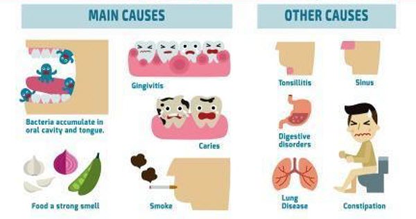 Causes of Halitosis